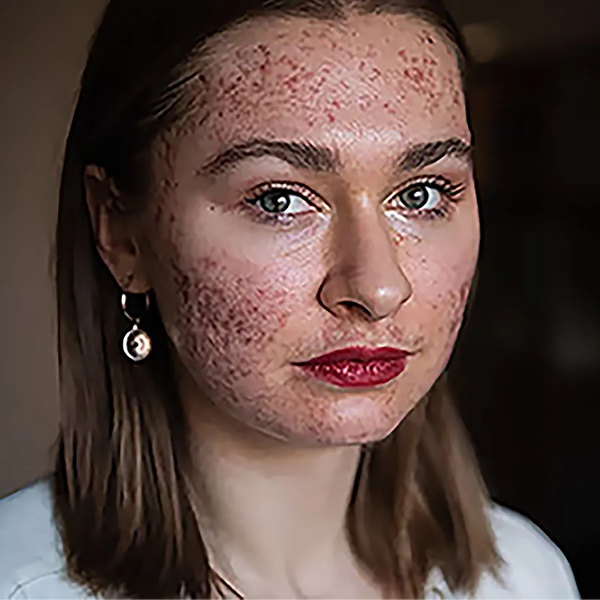 Portrait with blemishes and redness retouched by Cherry — before