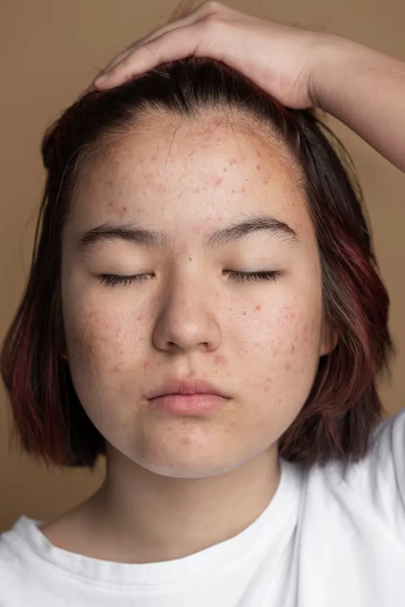 Portrait with breakouts retouched by Cherry — before