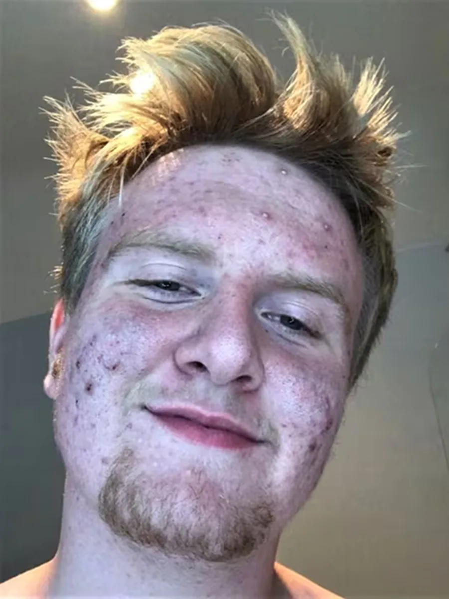 Selfie retouched by Cherry, beard kept — before